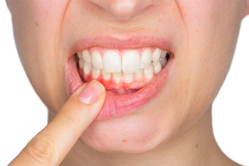 Nha chu là một phức hợp bao gồm: nướu, xương ổ răng, dây chằng, nướu và gai nướu. Họ bao phủ răng và cung cấp hỗ trợ.