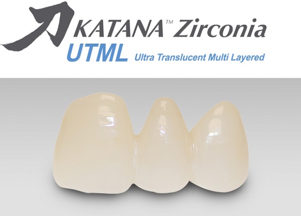 Răng sứ zirconia và những ưu điểm