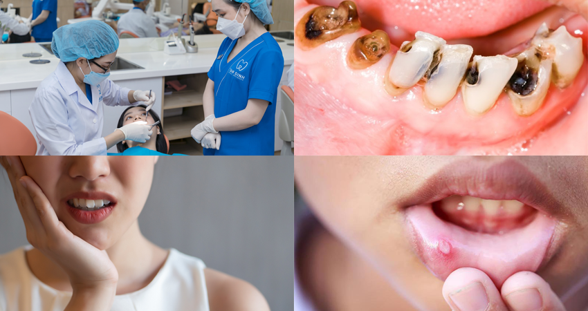 Các bệnh răng miệng cần chú ý trong mùa hè