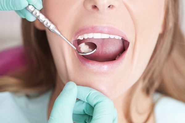Thực hiện các biện pháp phòng ngừa để bảo vệ sức khỏe răng miệng