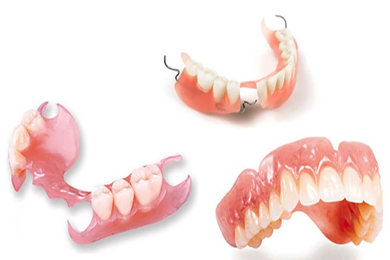 Hàm giả tháo lắp toàn hàm là phương pháp làm răng giả thường được áp dụng cho những người cao tuổi bị mất răng toàn hàm. Cấu tạo của một hàm giả tháo lắp toàn hàm bao gồm một nền hàm hay hàm tháo lắp, bên trên là các răng giả.