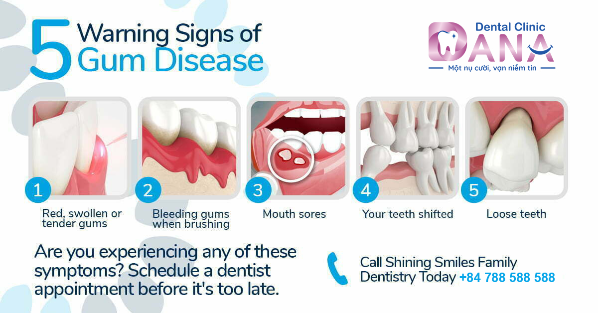 Signs to help you recognize periodontitis or gum disease