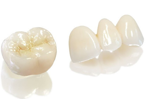 Những ưu điểm vượt trội của răng sứ Zirconia