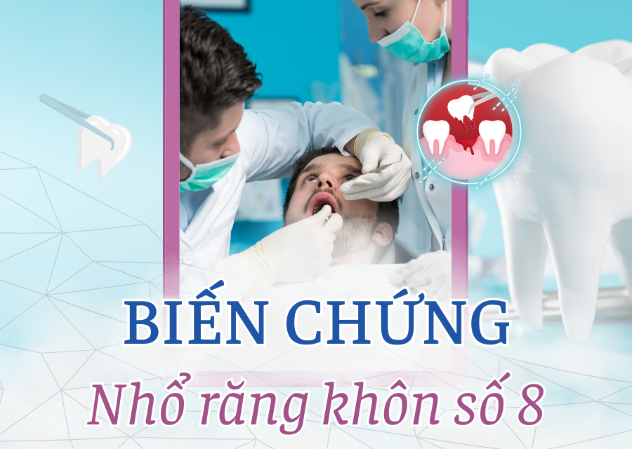 3 biến chứng nhổ răng số 8 cần đặc biệt lưu ý