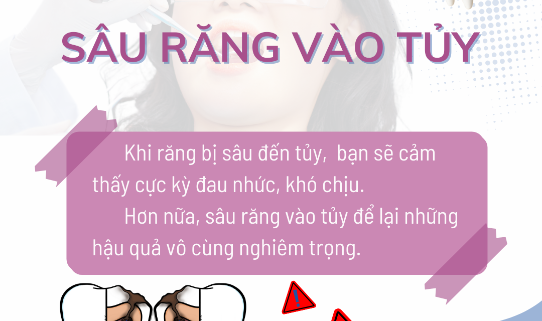 Sâu răng vào tủy có nguy hiểm không? Chữa như thế nào?