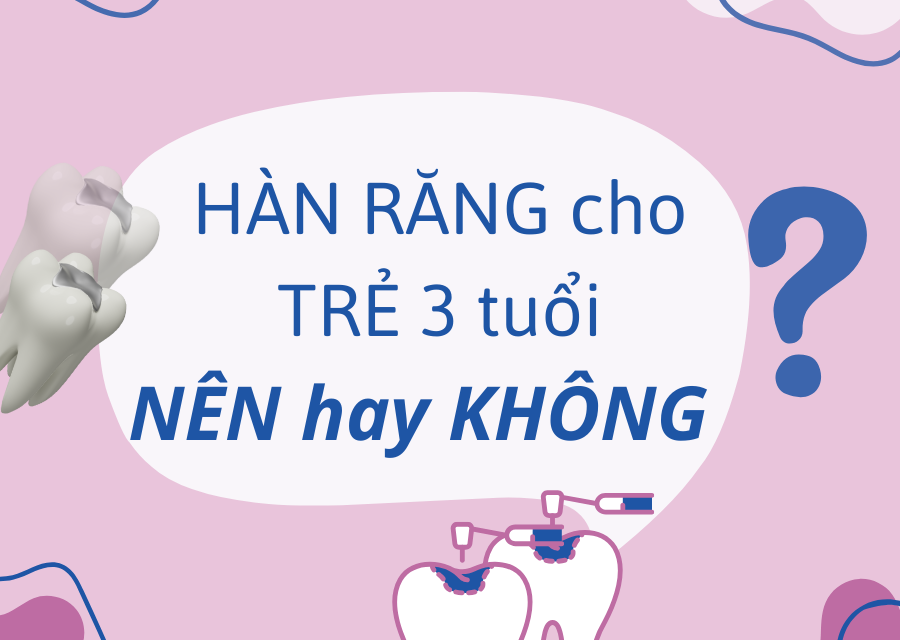 Trẻ 3 tuổi hàn răng được không? Cần chú ý gì khi thực hiện?